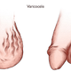 Illustration for article titled Obat Herbal Buat Varikokel